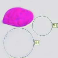 Spores of Atheniella adonis