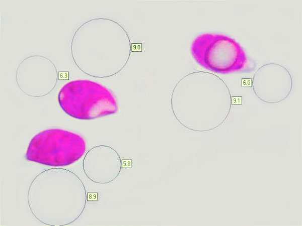 Spores of Atheniella adonis