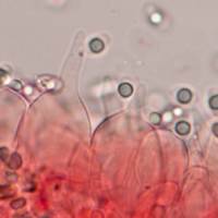 Cheilocystidia of Mycena abramsii