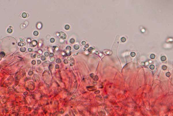 Cheilocystidia of Mycena abramsii