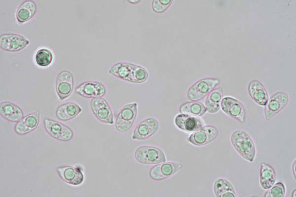 Spores of Mycena aetites