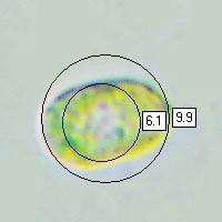 Spores of Mycena crocata