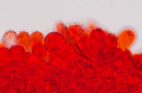 Cheilocystidia of Mycena flavescens