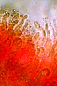 Cheilocystidia of Mycena galericulata