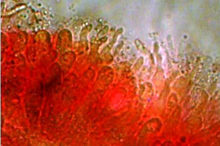Cheilocystidia of Mycena galericulata