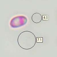Spores of Mycena pelianthina