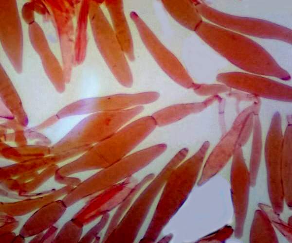 Spores of Pluteus ephebeus