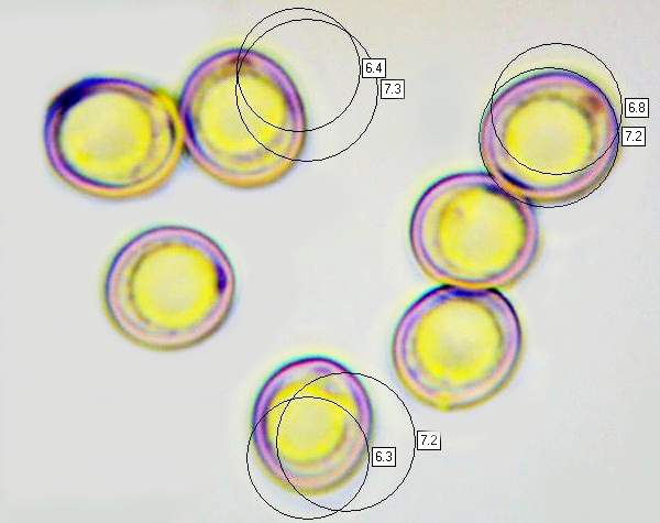 Spores of Pluteus ephebeus