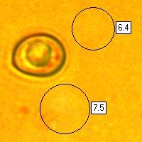 Spores of Pluteus phlebophorus, Wrinkled Shield