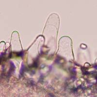 Cheilocystidia of Pluteus podospileus