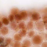 Pileipellis of Pluteus podospileus