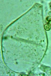 Pluteus romellii, gill-edge cystidia