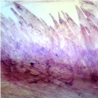 Pileipellis of Pluteus roseipes