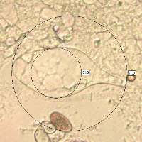 Cheilocystidia of Volvopluteus gloiocephalus, Stubble Rosegill