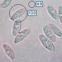 Spores of Polyporus squamosus, Dryad's Saddle fungus