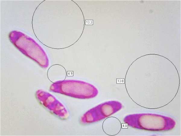 Spores of Polyporus squamosus