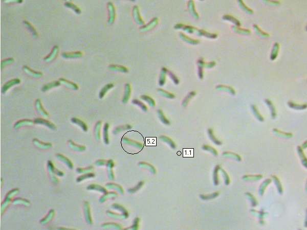 Spores of Trametes pubescens