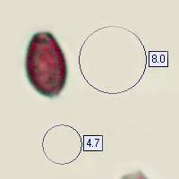 Spores of Coprinellus disseminatus