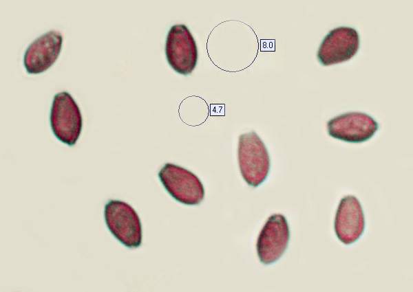Spores of Coprinellus disseminatus