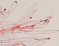 Cap structure of Coprinopsis lagopus