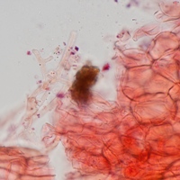 Pileipellis of Coprinopsis xenobia