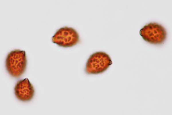 Spores of Lacrymaria lacrymabunda