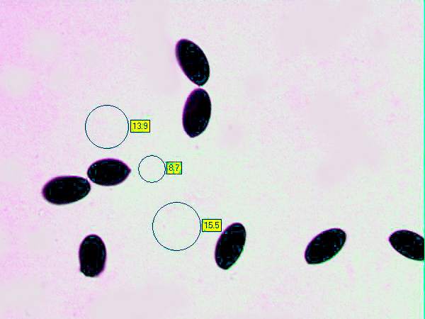 Spores of Parasola conopilus