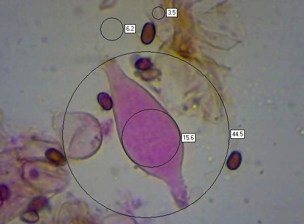 Pleurocystidia of Psathyrella laevissima