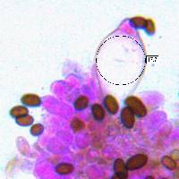 Cheilocystidia of Psathyrella piluliformis