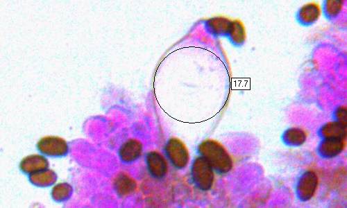 Cheilocystidia of Psathyrella piluliformis