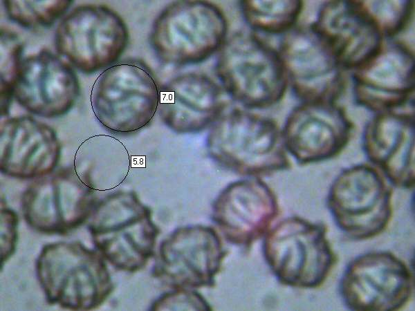 Spores of Lactarius blennius