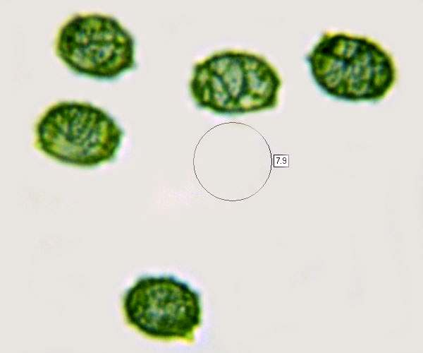 Spores of Lactarius chrysorrheus