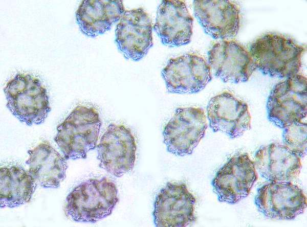Spores of Lactarius pubescens