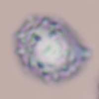 Spores of Lactarius tabidus