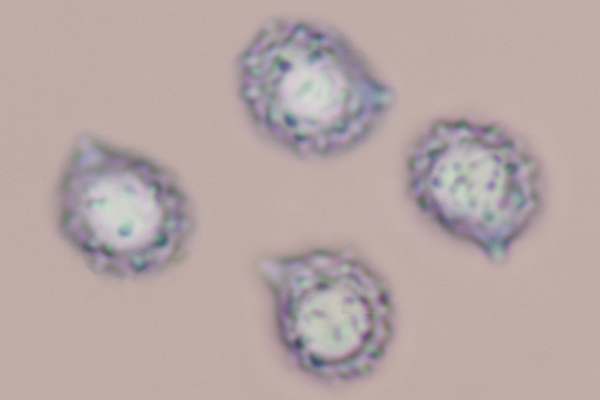 Spores of Lactarius tabidus