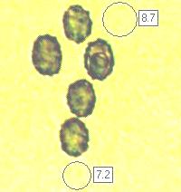Spores of Lactarius torminosus