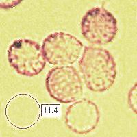 Spores of Russula aeruginea