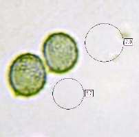 Spores of Russula aurea