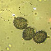 Spores of Russula claroflava, the Yellow Swamp Brittlegill