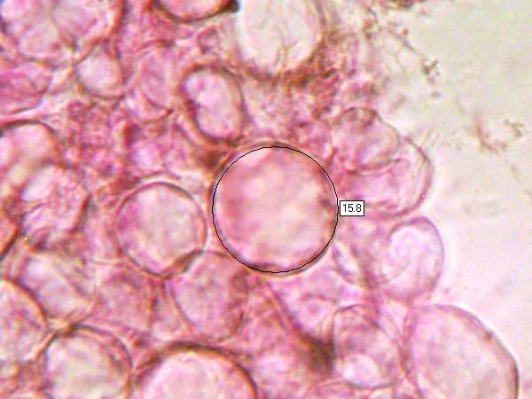 Sphaerocysts of Russula fragilis