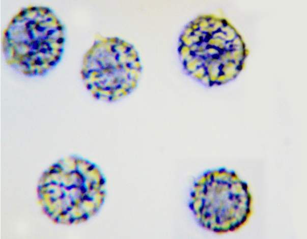 Spores of Russula nigricans