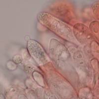 Cheilocystidia of Russula parazurea