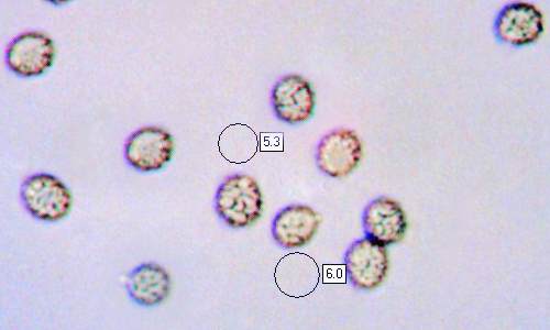 Spores of Russula parazurea