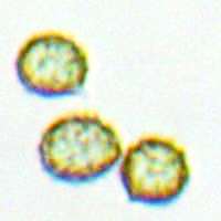 Spores of Russula queletii