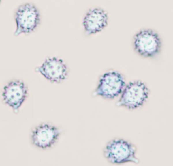 Spores of Russula sanguinaria