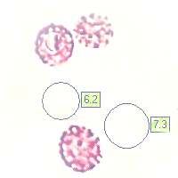 Spores of Russula virescens