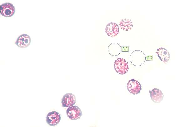 Spores of Russula virescens