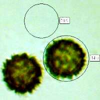 Spores of Scleroderma areolatum