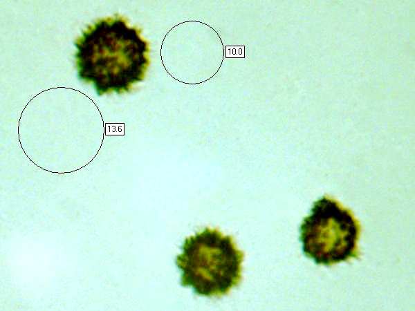 Spores of Sarcoscypha austriaca