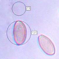 Spores of <em>Agrocybe molesta</em>